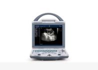 Mobile Ultrasound Scanner Portable Ultrasound Scanner with Transvaginal Linear Convex Probe