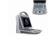 Digital Color Doppler Portable Ultrasound Equipment With PW CFM THI Mode