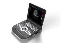 Portable Ultrasound Device Portable Ultrasound Scanner Color Doppler with 2 USB Ports