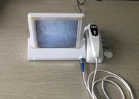 Handhled Digital Skin Moisture And Oil Analyzer With Professional Software Analysis