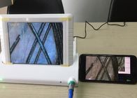 Digital Magnifier Handheld Video Dermatoscope Skin Analyzer with Data Report of Oil Moisture Pigment Flexible