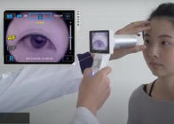 Handheld Digital Fundus Camera With True 5MP Image Resolution And 45° FOV Support 2G to 32G Files Storge