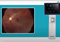 Ophthalmic Equipment Digital Fundus Camera With 3.5&quot; Full Color TFT-LCD Touch Panel Auto / Manual Focus