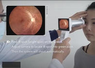 Telemedicine In Ophthalmology Digital Fundus Camera View Angle of 45 Degree Optional Wifi Software For Report