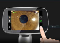 Diagnosis Anterior Disease 10X Digital Ophthalmology Equipment