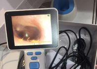 4 Natural White LED Medical Video USB Otoscope  Otoscopy With Image Stored in Computer Diameter of Lense 0.5cm