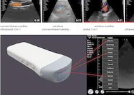 IOS Android Windows Handheld Portable Ultrasound Device Convex Linear Cardiac 3 IN 1 Ipad Ultrasound Probe