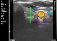 Home Doppler Ultrasound Portable Diagnostic Hand held Doppler Ultrasound Obstetric Gynecology Pediatrics Application