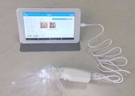 Portable Self-Colposcope For Gynecology Connected To Monitor Computer Television