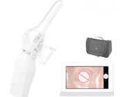 Cervix Camera Video Camera for Vaginal Handheld Digital Mini Colposcope Self - Inspection with 1.5 Times Magnification