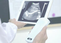 Pregnancy Wifi Color Doppler Ultrasound Scanner With Ob / Gyn Measurement