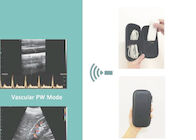 Ce Linear 7.5mhz Wifi Portable Ultrasound Scanners