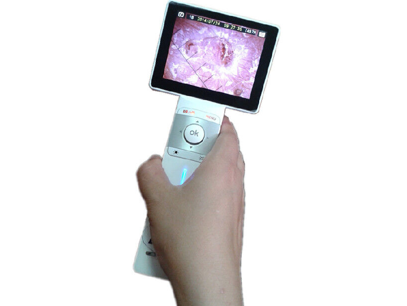 Digital Skin Camera Hair Magnifier Machine With Mini USB Port Transmit
