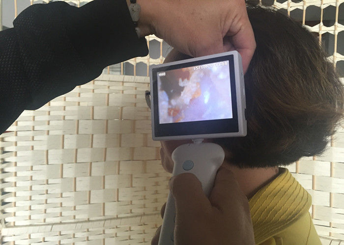 Digital ENT Otoscope Ophthalmoscope And Nasal Endscope Handheld Video