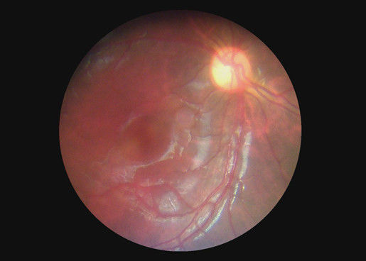 Ophthalmic Optical Equipment Throat Camera Video Otoscope Dermatoscope Digital Endoscope With 2 Million Pixels