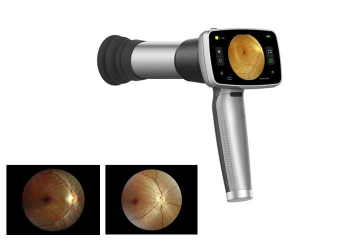 Handheld Fundus Camera Portable Otoscope Ophthalmoscope With 3.97 Inch