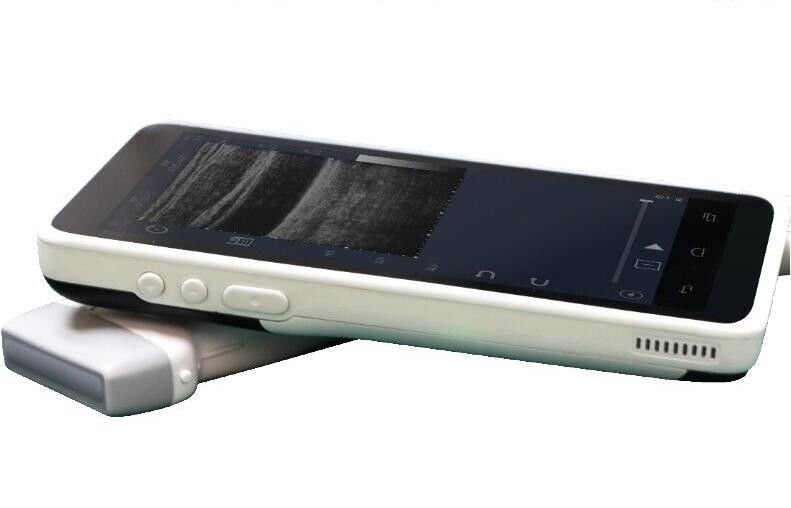 Mini Color Doppler Handheld Sonogram Device With 128 Elements 1280*720 Resolution