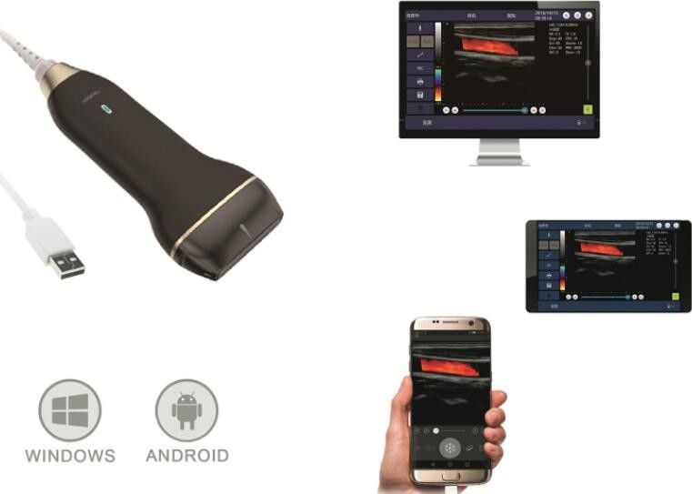 usb port home color doppler ultrasound scanner with 5 10 mhz frequency