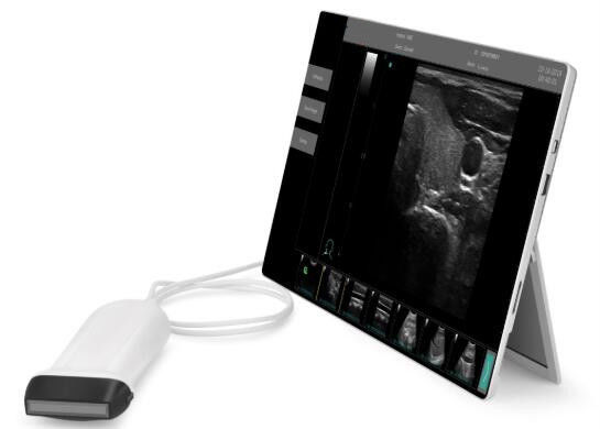 Ultrasound Scan Equipment Portable Ultrasound Scanner Ipad Ultrasound Machine with Probes of 2~15MHz