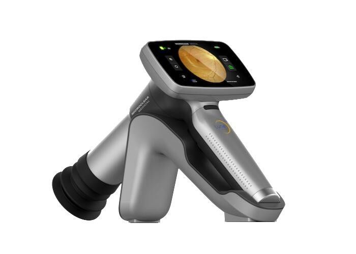 2.5mm Android System Digital Fundus Camera 1920x1080