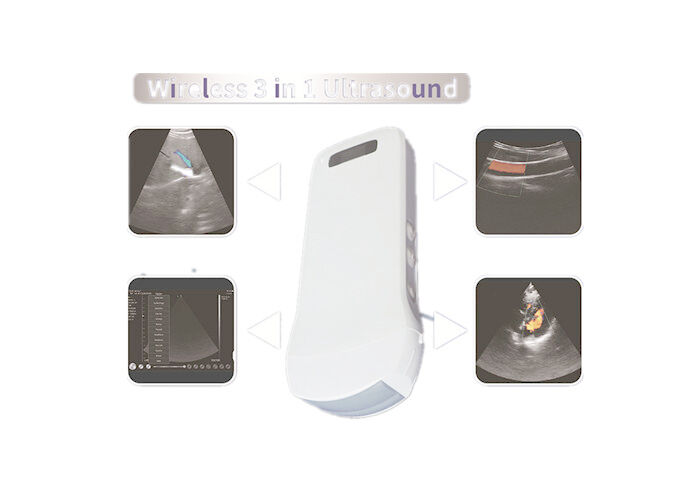 Color Doppler Sonography Color Doppler Ultrasound Scanner With Built-in WiFi Signal Wireless Charging 2.5MHz~10MHz Freq