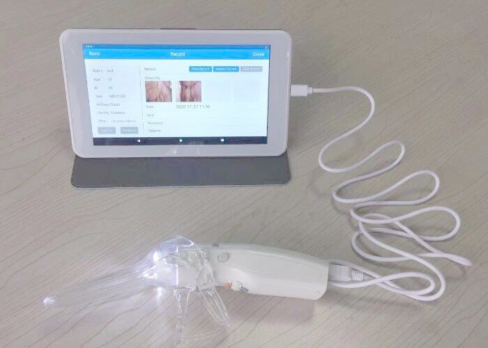 Digital Video Colposcope for Woman Care 10 or 7 Inch Medical Monitor Professional Camera for Inspection of Cervix