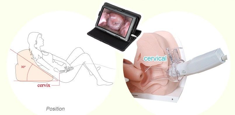 Healthcare Product Gynecological Endoscopic Digital Electronic Colposcope For Women Home Use