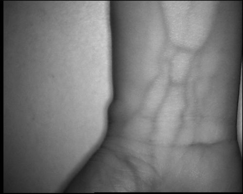 800X480 Table Type Vein Locator Device