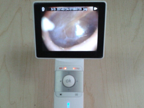 Professional Digital Video Otoscope