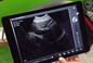 Ipad Ultrasound Scanner Wireless Ultrasound Probe Only 308g Weight USB Connection