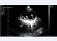 Personal Ultrasound Scanner Linear+Cardiac Probe 2.2MHz Mobile DICOM Format
