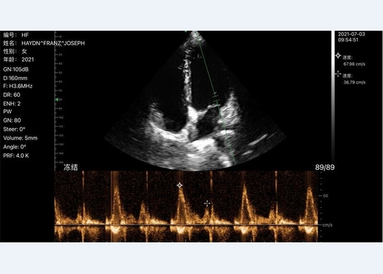 Ultrasound Scanner Phased Array Probe Portable Laptop Machine 2.2-3.6mhz 7.5/10mhz