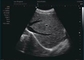 Doppler Ultrasound In Pregnancy Home Doppler Ultrasound Probe Frequency 12MHz