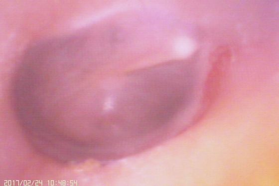 720X480 Digital Video Otoscope