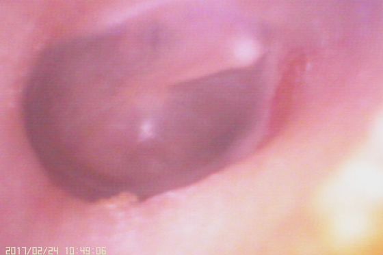 720X480 Digital Video Otoscope