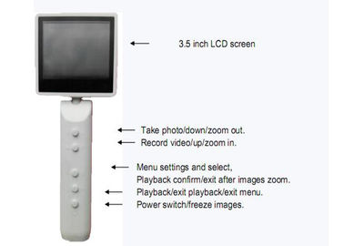 Full HD Portable Video Otoscope Camera Endoscopy Medical USB ENT Endoscope With 3.5 Inch LCD Screen