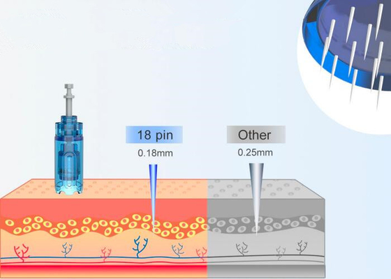 95-145 / Sec Derma Pen With Working Frequency And Needle Adjustment Of 0-2.5mm