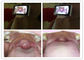 Micro SD Memory Card Digital Ear Inspection Device Video General Imaging Lens For Throat Inspection