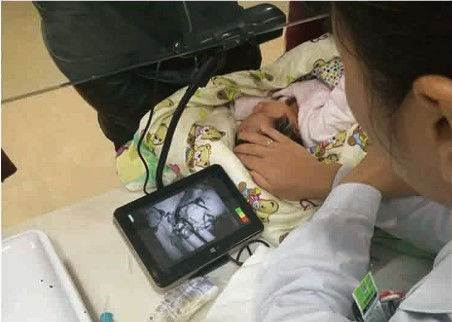 Portable Economical Infrared Vein Finder