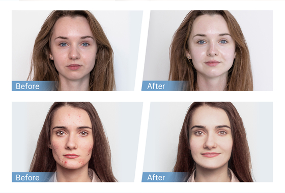 Latest 4-Pole EMS Automatcal Serum Applicator Hydra Pen H5 Face Skin Derma Microneedling Pen Essence Collagen Regeneration