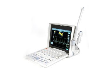 1024 Frame Laptop Color Doppler Device Portable Ultrasound Scanner With 2 Probe Connector