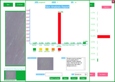 Professional Video Dermatoscope Analysis System With Analysis And Testing Report