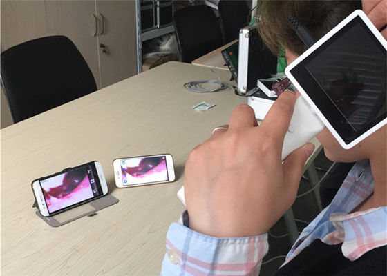 720X480 Digital Video Otoscope