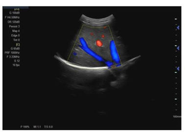 Super Color Handheld Ultrasound Doppler Medical Equipment 3D Or 4D Optional