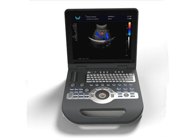 Color Doppler Ultrasound Machine Ultrasound Medical Equipment With 5 Kinds Languages