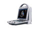 Digital Color Doppler Machine Laptop Ultrasound Scanner Diagnostic Color System