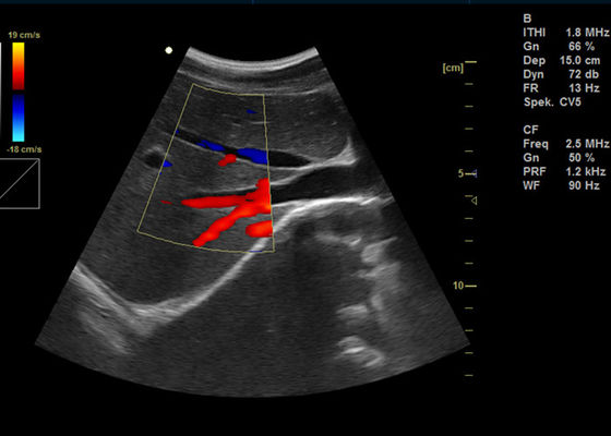 Full Digital Color Doppler Machine