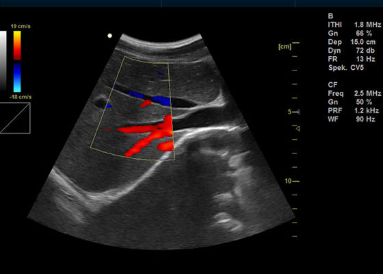 Full Digital Color Doppler Machine
