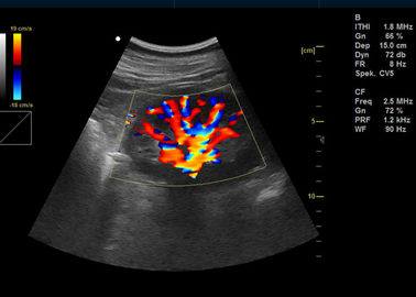 15”LED Portable Color Doppler Machine Digital Color Ultrasonic Diagnostic System