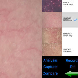 Wifi Skin And Scalp Tester Wireless Skin Analyser Digital With 8" Screen 9 Photoes Displaying